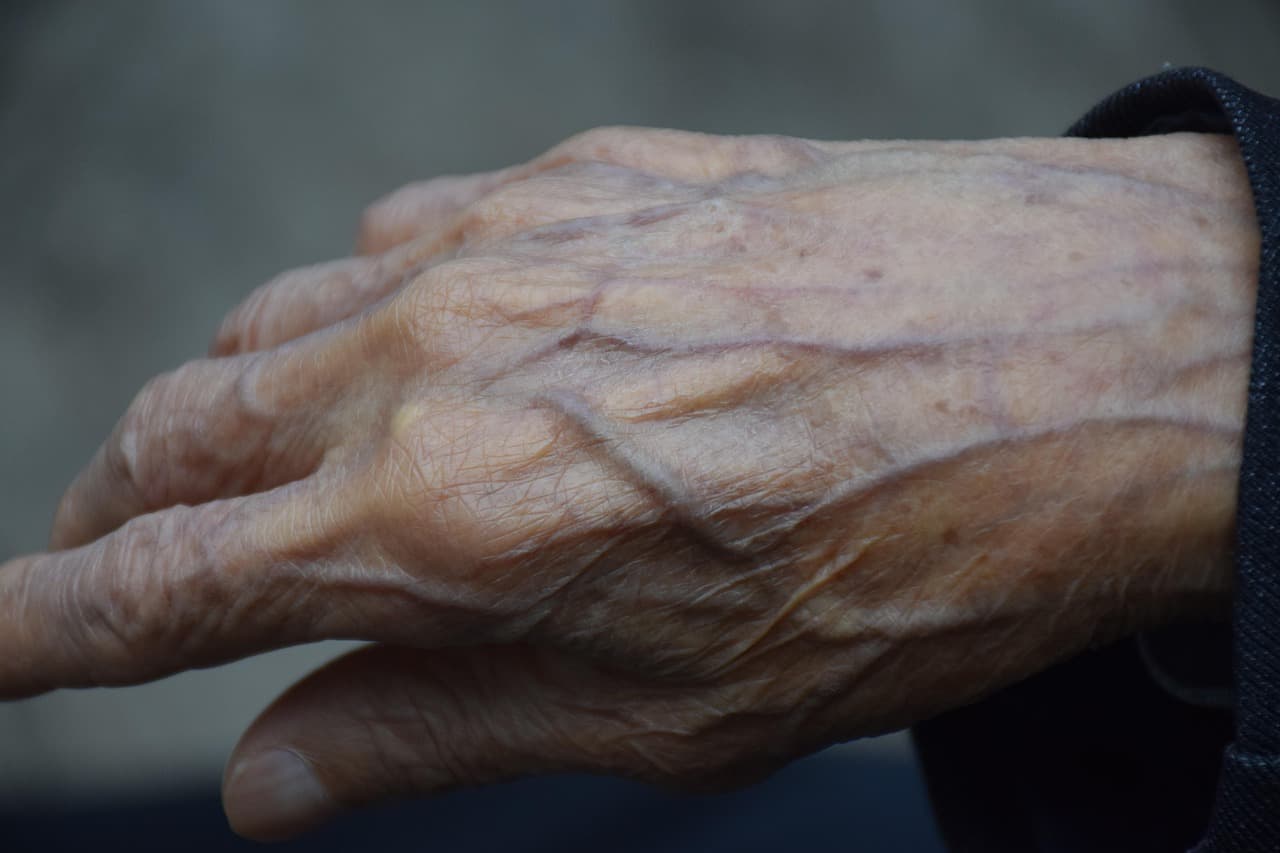 Mano anciana arrugada apoyada sobre una mesa de madera, en el chat de Meridian